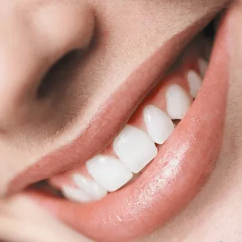 Odontologijos Įranga MPT standarto Dantis dantų Balinimo 44% Peroksido Balinimo Sistema, Burnos higienos priežiūros Gelis dūmų dantys