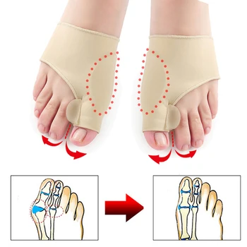 1Pair Guz Kojų Separatorius Hallux Valgus Kojų tiesinimo priemonė Pedikiūro Įtvaras Pėdos Įrankiai Guz Korektorius Ortopedijos Reguliatorius