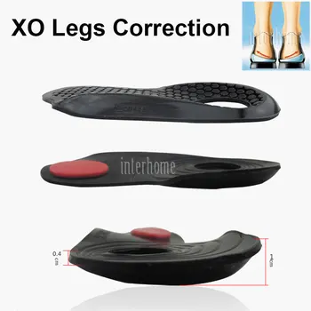 Originalus X/O tipo kojos Orthotic Silikono Ortopedinių Vidpadžių Plokščių Pėdų Korekcijai Grožio Kojas, Kūno Formavimas Pėdų Priežiūros Batai Padas