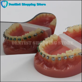 Ortodontinis Dantų Fotografijos Stiklo Veidrodis Dvigubo Pusėje Odontologijos Klinika Tikrinimas
