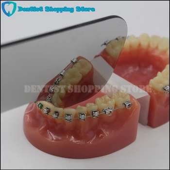Ortodontinis Dantų Fotografijos Stiklo Veidrodis Dvigubo Pusėje Odontologijos Klinika Tikrinimas